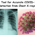 AI Tool for Accurate COVID-19 Detection from Chest X-rays